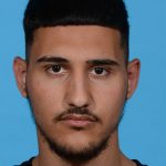 before rhinoplasty male patient front view case 3536