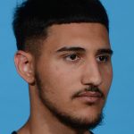 before rhinoplasty male patient angle view case 3536
