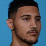 after rhinoplasty male patient angle view case 3536