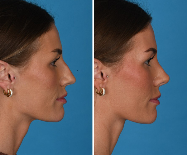 Screenshot 2025-11-06 094852