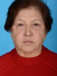 before neck lift front view female no smile patient case 8341