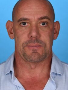 after neck lift front view male patient case 8408