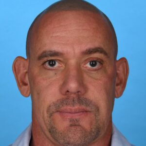 after rhinoplasty front view male patient case 8469